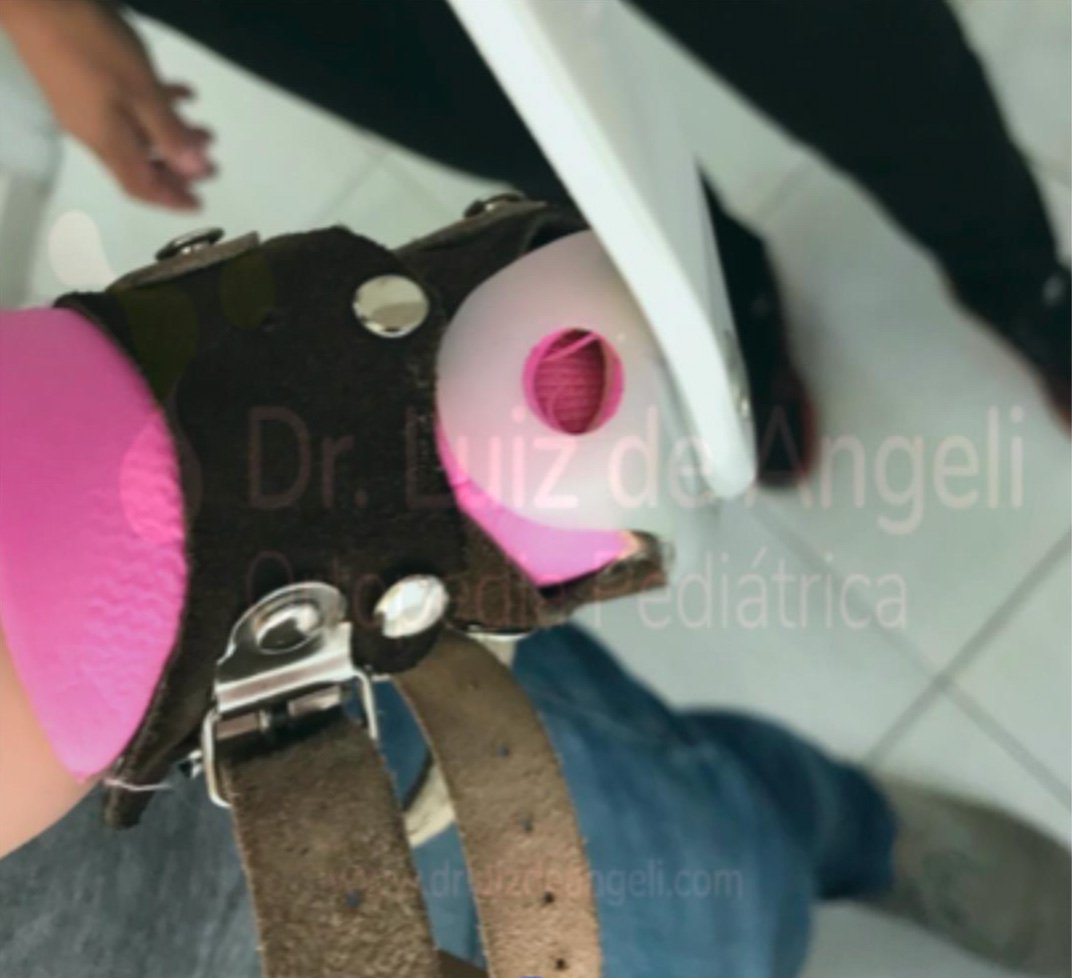 Checagem da colocação | Dr. Luiz de Angeli