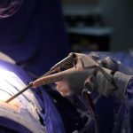 Endoscopia de de Coluna | Dr. Ricardo Teixeira