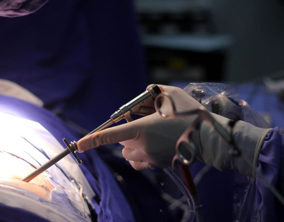 Endoscopia de de Coluna | Dr. Ricardo Teixeira